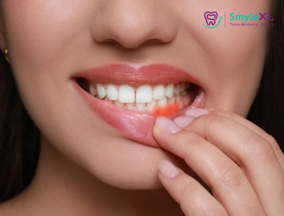Gum Treatment in Chitradurga