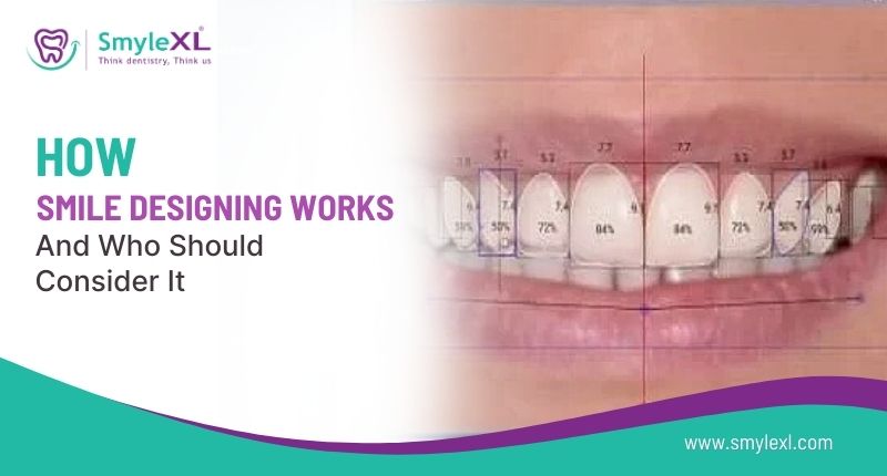 How Smile Designing Works and Who Should Consider It?