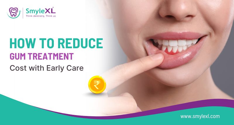 How to Reduce Gum Treatment Cost with Early Care?