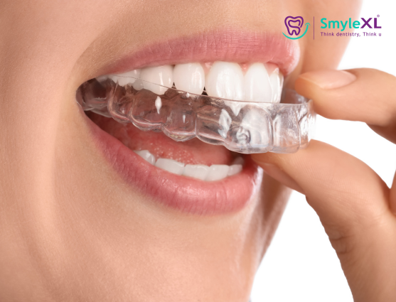 Invisible Braces in Chitradurga