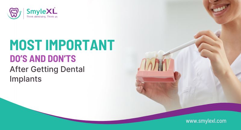Most Important Do’s and Don’ts After Getting Dental Implants