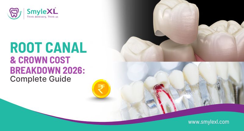 Root Canal and Crown Cost Breakdown 2026: Complete Guide