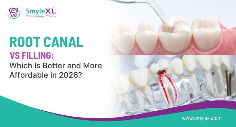 Root Canal vs Filling: Which Is Better and More Affordable in 2026?