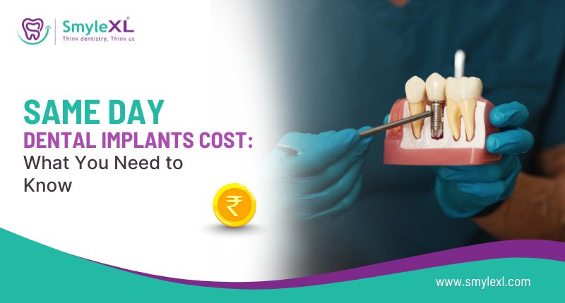 Same Day Dental Implants Cost: What You Need to Know