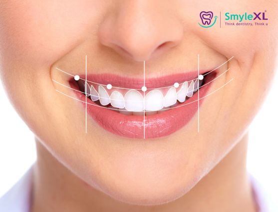 Smile Designing Treatment in Chitradurga
