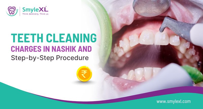 Teeth Cleaning Charges in Nashik and Step-by-Step Procedure