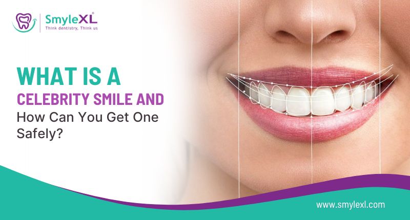 What Is a Celebrity Smile and How Can You Get One Safely?