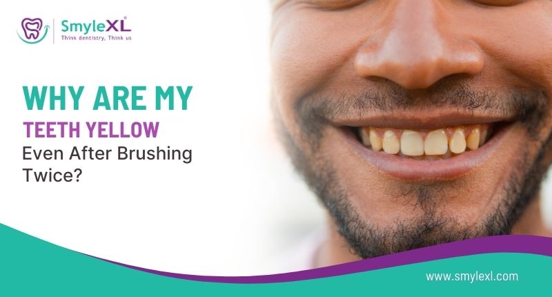 Why Are My Teeth Yellow Even After Brushing Twice?