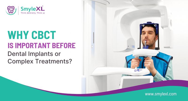 Why CBCT Is Important Before Dental Implants or Complex Treatments?