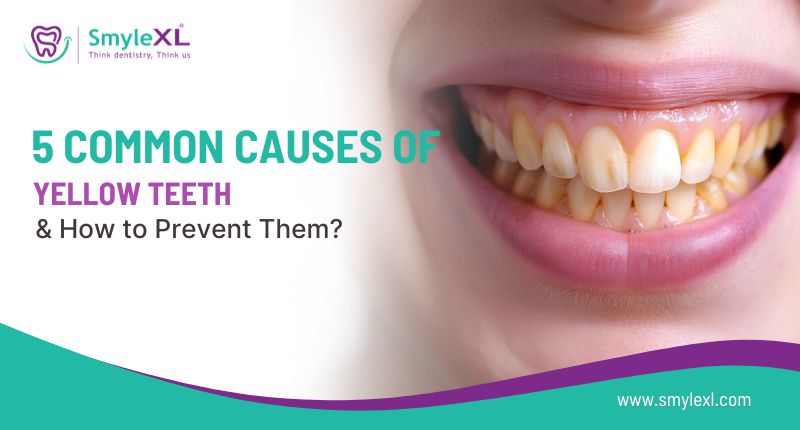 5 Common Causes of Yellow Teeth and How to Prevent Them