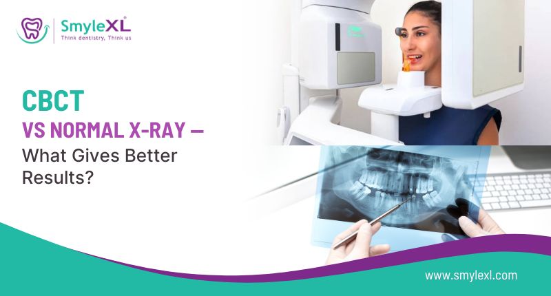 CBCT vs Normal X-Ray: What Gives Better Results?