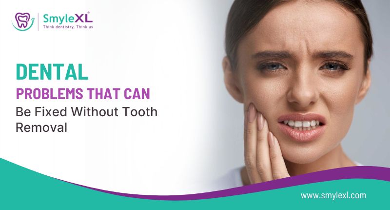 Dental Problems That Can Be Fixed Without Tooth Removal