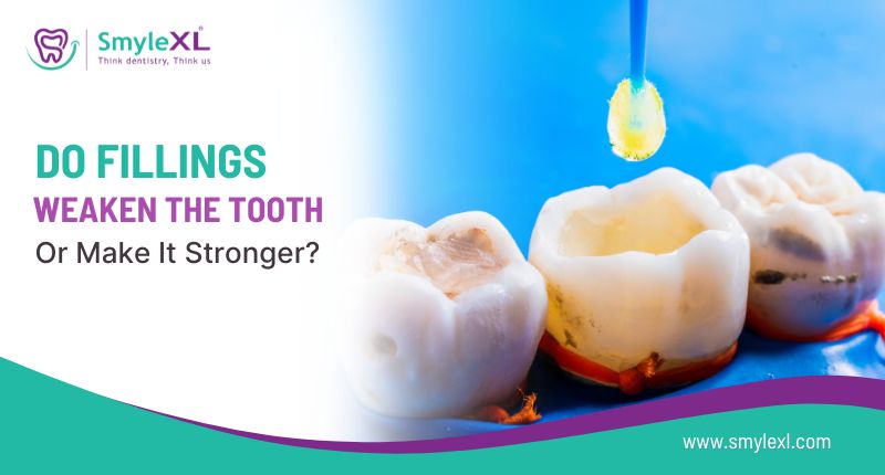 Do Fillings Weaken the Tooth or Make It Stronger?