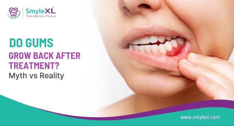 Do Gums Grow Back After Treatment? Myth vs Reality