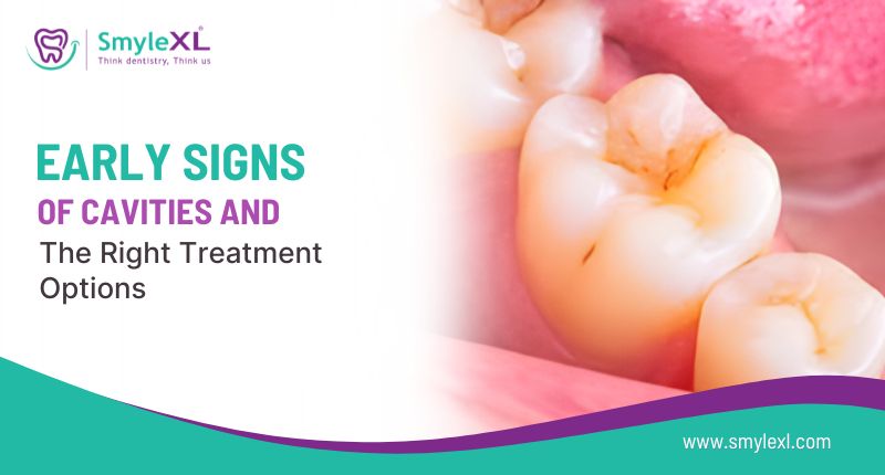 Early Signs Of Cavities And The Right Treatment Options