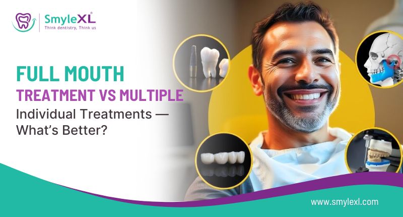 Full Mouth Treatment vs Multiple Individual Treatments – What’s Better?