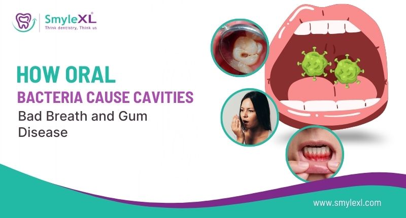 How Oral Bacteria Cause Cavities, Bad Breath, and Gum Disease?