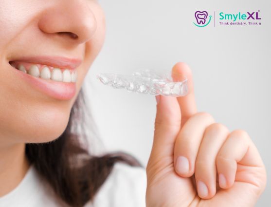 Invisible Braces in Kalyan West