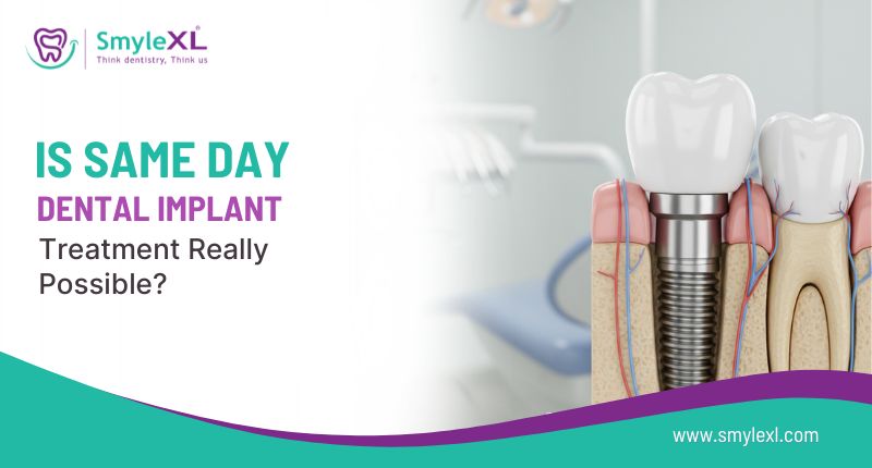 Is Same-Day Dental Implant Treatment Really Possible?