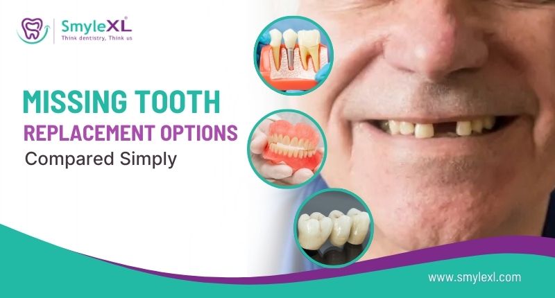 Missing Tooth Replacement Options Compared Simply