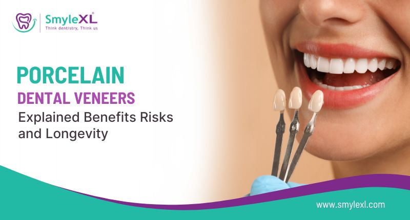Porcelain Dental Veneers Explained: Benefits, Risks and Longevity