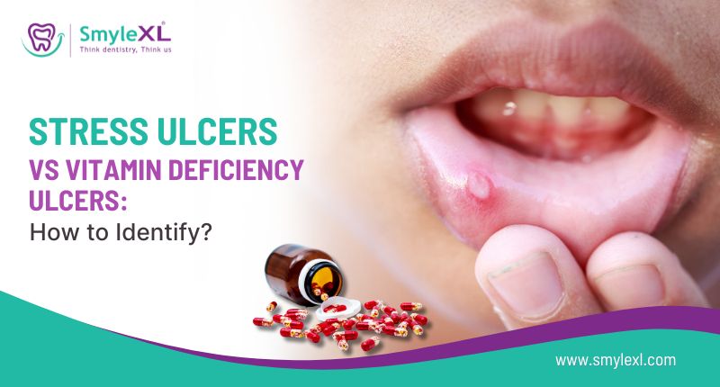 Stress Ulcers vs Vitamin Deficiency Ulcers: How to Identify?