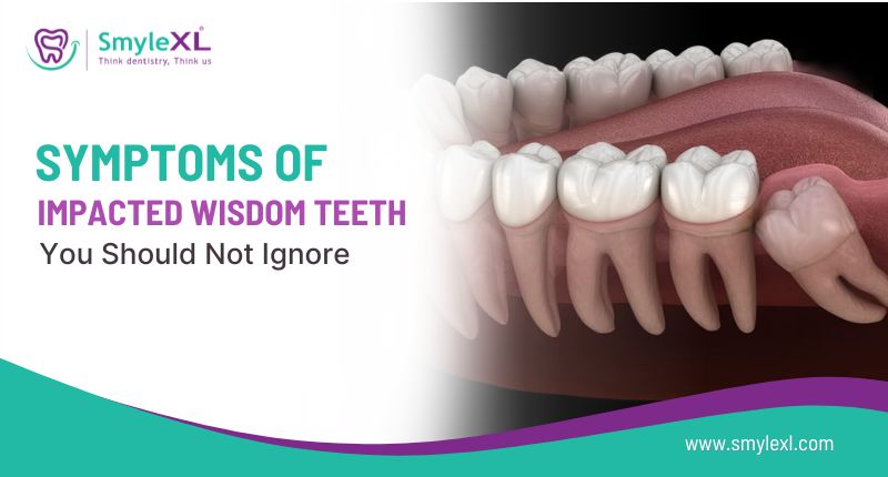 Symptoms of Impacted Wisdom Teeth You Should Not Ignore