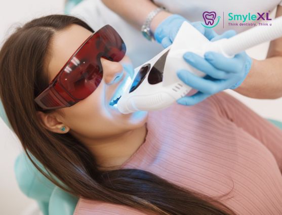 Teeth Whitening in Kalyan West