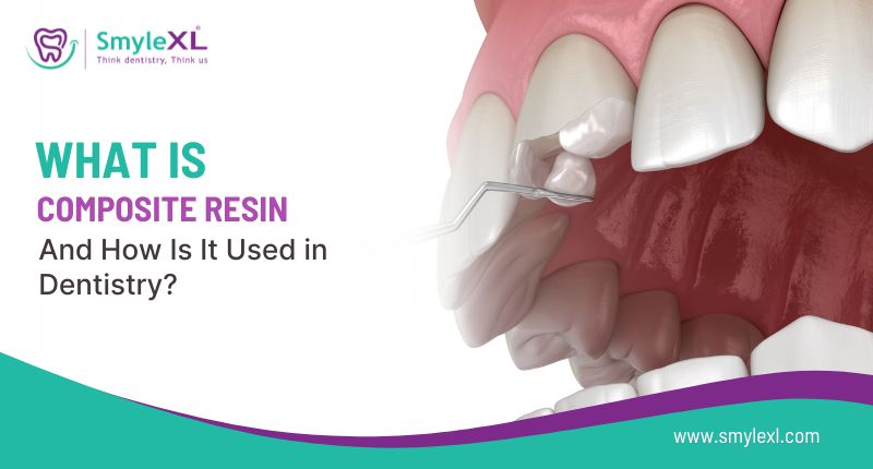 What Is Composite Resin and How Is It Used in Dentistry?