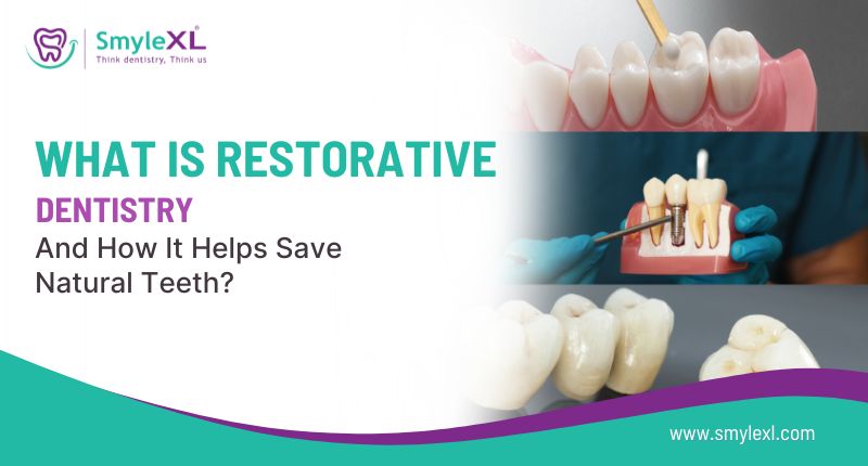 What Is Restorative Dentistry and How It Helps Save Natural Teeth?