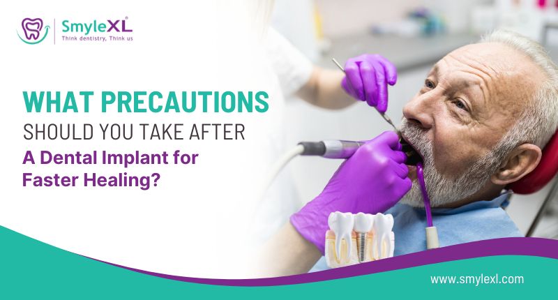 What Precautions Should You Take After a Dental Implant for Faster Healing?