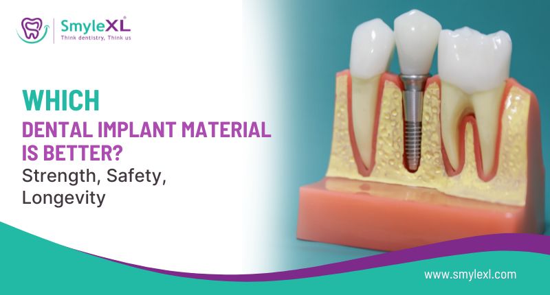 Which Dental Implant Material Is Better? Strength, Safety, Longevity