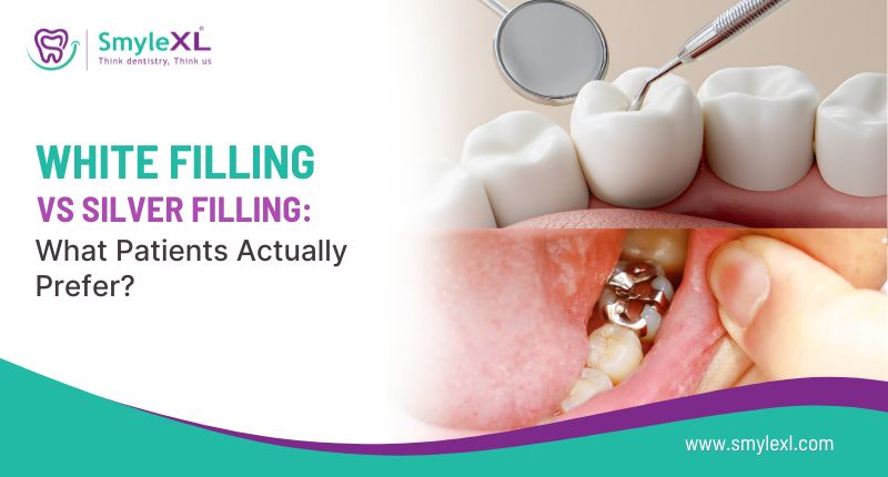 White Filling vs Silver Filling: What Patients Actually Prefer?