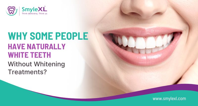 Why Some People Have Naturally White Teeth Without Whitening Treatments?