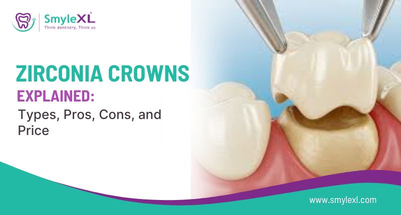 Zirconia Crowns Explained: Types, Pros, Cons, and Price