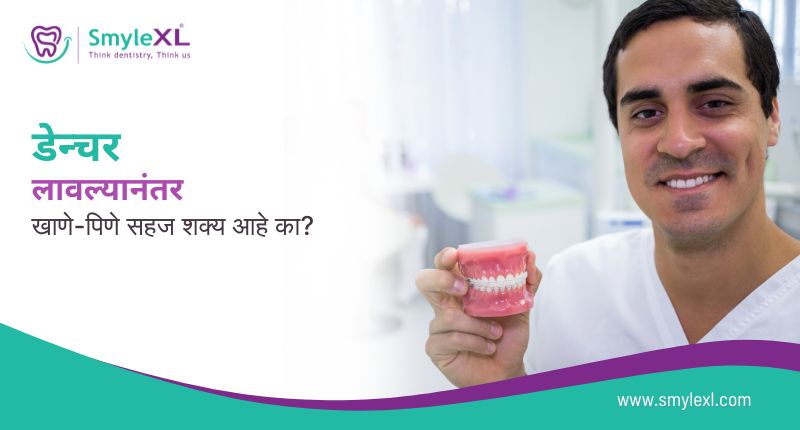 डेन्चर लावल्यानंतर खाणे-पिणे सहज शक्य आहे का?