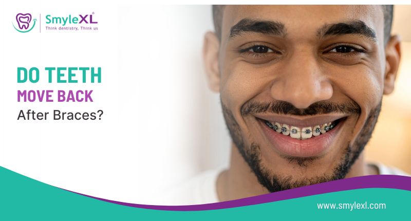 Do Teeth Move Back After Braces?