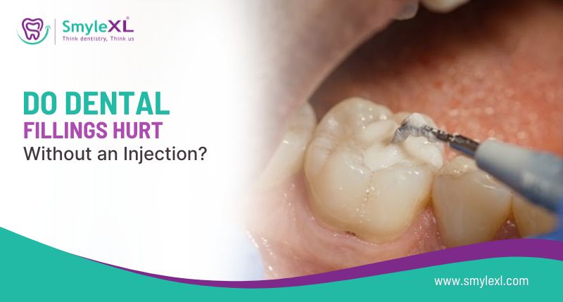 Do Dental Fillings Hurt Without an Injection?