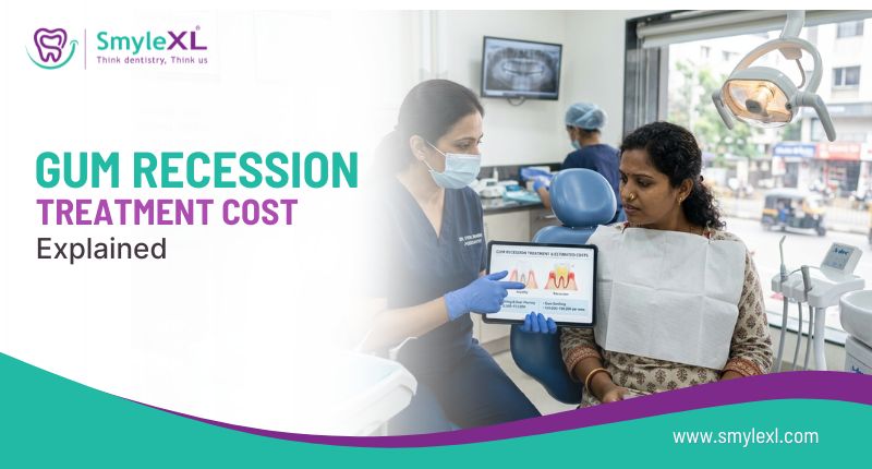 Gum Recession Treatment Cost Explained