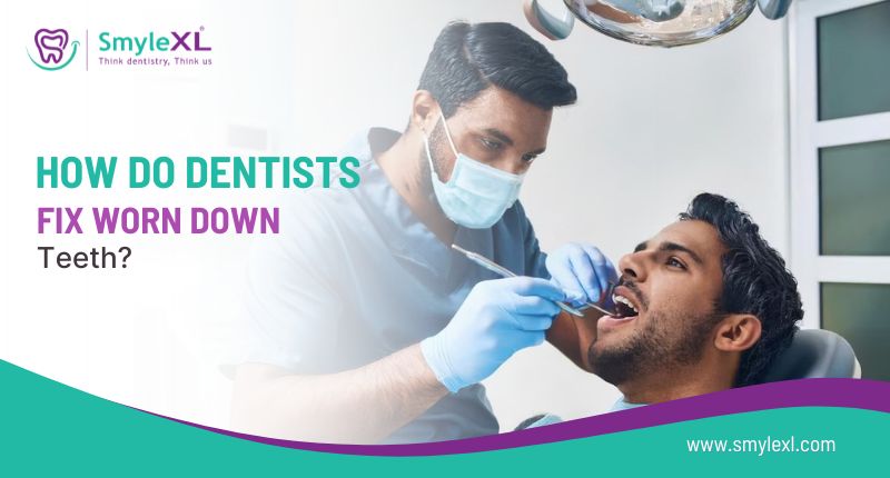 How Do Dentists Fix Worn Down Teeth?