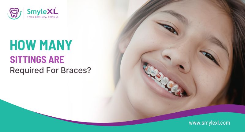 How Many Sittings Are Required for Braces?