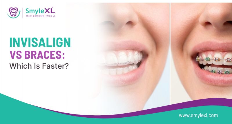Invisalign vs Braces: Which Is Faster?