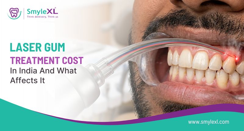 Laser Gum Treatment Cost in India and What Affects It