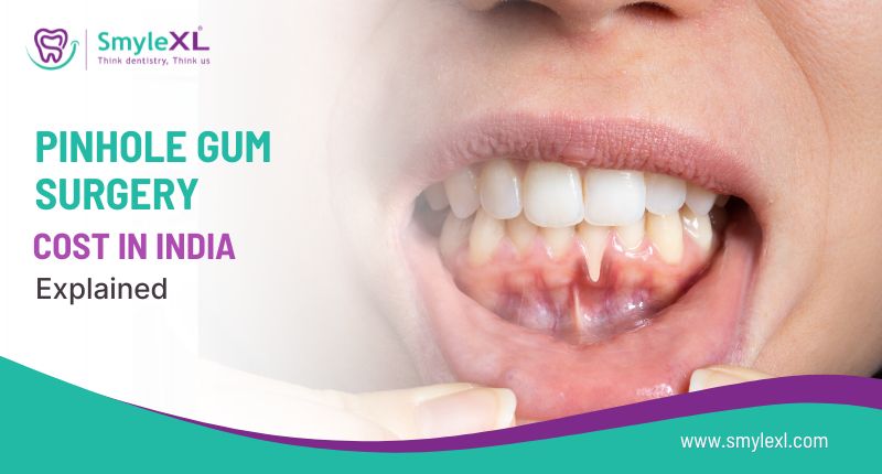 Pinhole Gum Surgery Cost in India Explained
