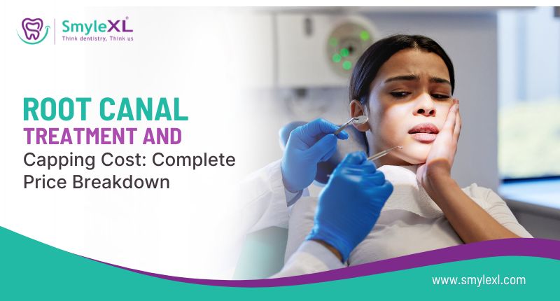 Root Canal Treatment and Capping Cost: Complete Price Breakdown