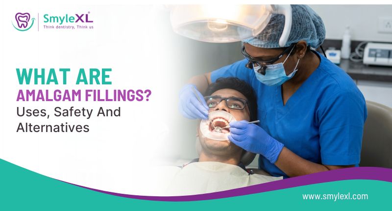 What Are Amalgam Fillings? Uses, Safety, and Alternatives