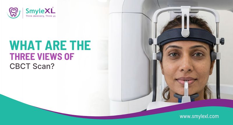 What Are The Three Views Of CBCT Scan?