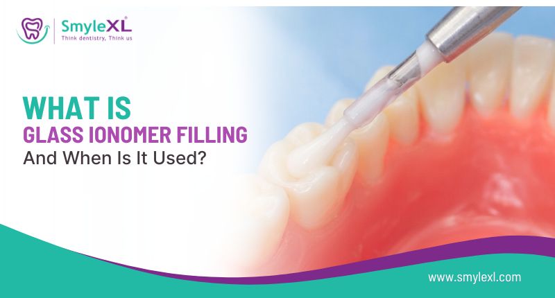 What Is Glass Ionomer Filling and When Is It Used?