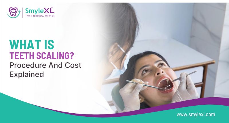 What Is Teeth Scaling? Procedure and Cost Explained