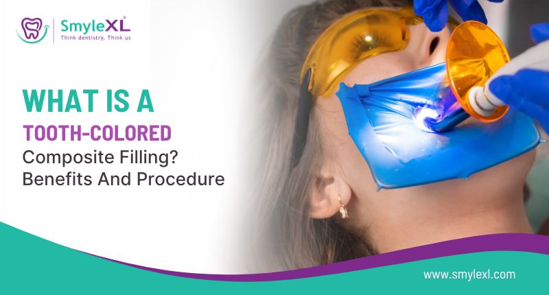 What Is a Tooth-Colored Composite Filling? Benefits and Procedure